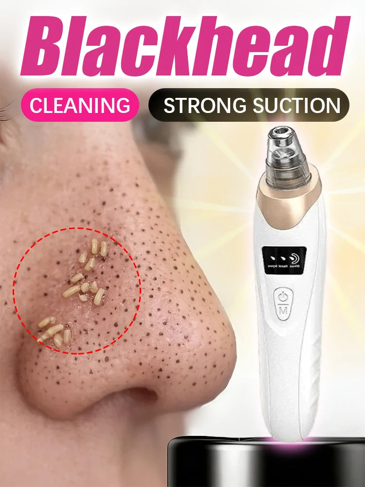 Deep Clean Blackhead Remover Vacuum – Pores Cleaner & Skin Care Device