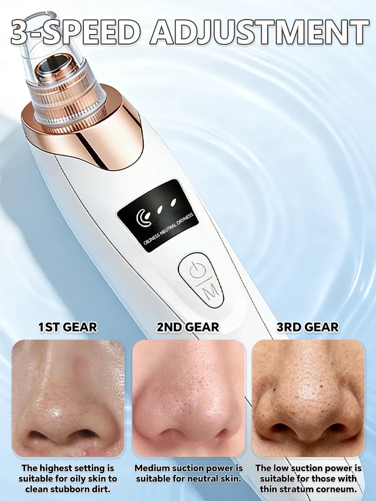 Deep Clean Blackhead Remover Vacuum – Pores Cleaner & Skin Care Device