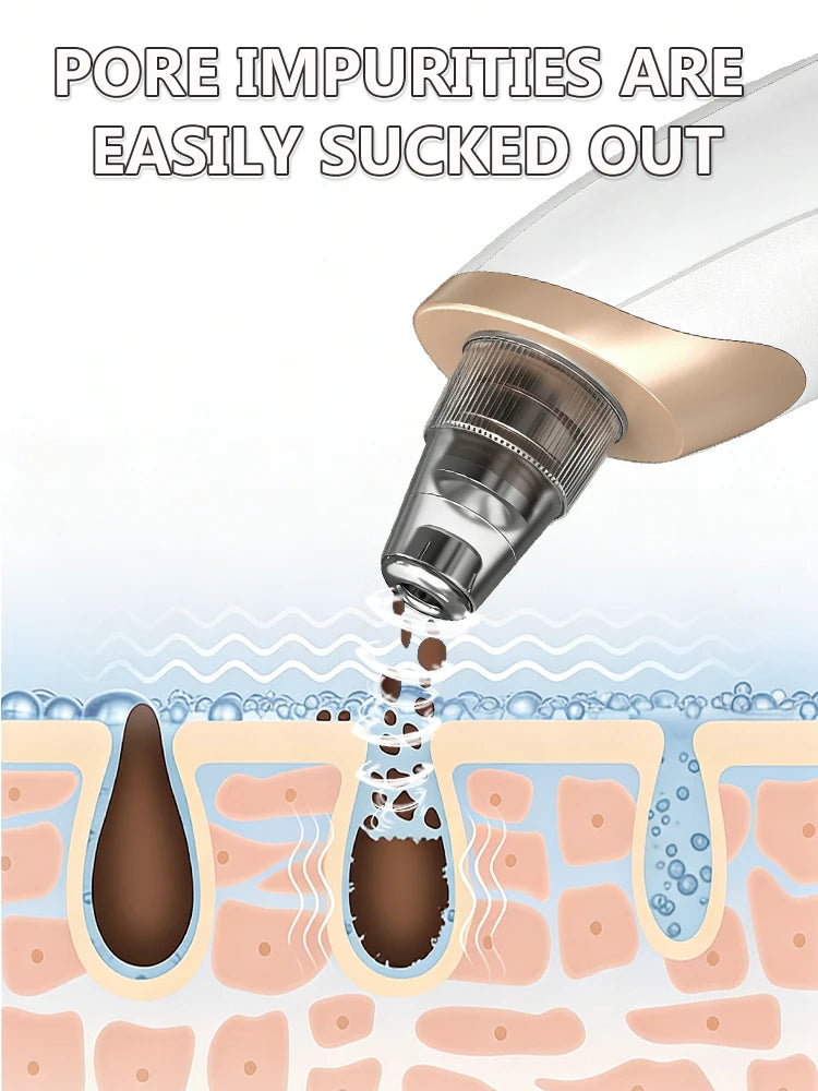 Deep Clean Blackhead Remover Vacuum – Pores Cleaner & Skin Care Device